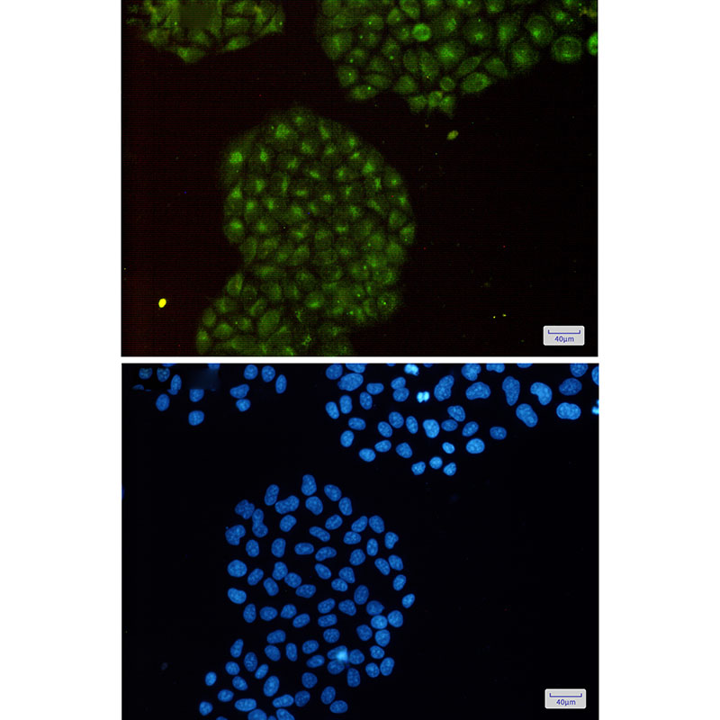 Proteasome beta 8 Rabbit mAb